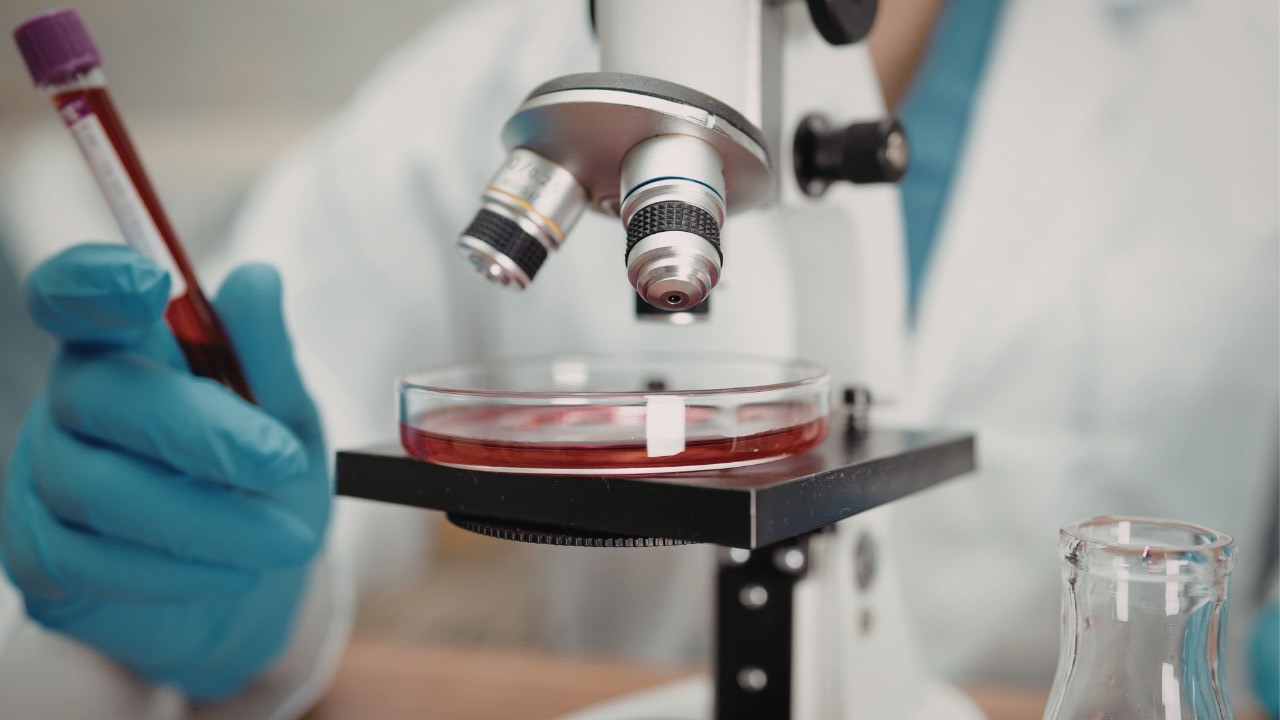 Live blood under a bright-field microscope